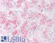 SLITRK6 Antibody - Anti-SLITRK6 antibody IHC of human liver. Immunohistochemistry of formalin-fixed, paraffin-embedded tissue after heat-induced antigen retrieval.