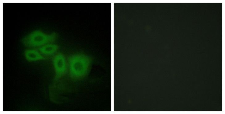 SLK Antibody - Immunofluorescence analysis of HepG2 cells, using SLK Antibody. The picture on the right is blocked with the synthesized peptide.