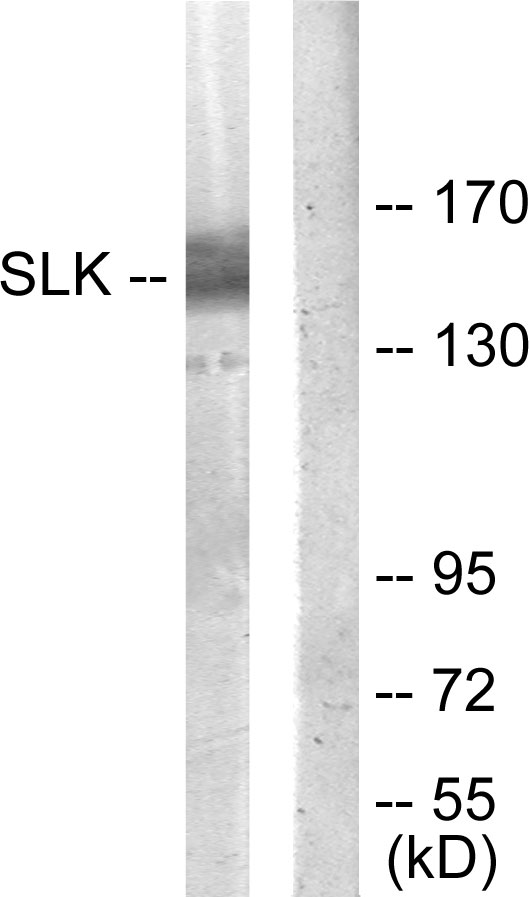 SLK Antibody - Western blot analysis of lysates from COLO205 cells, using SLK Antibody. The lane on the right is blocked with the synthesized peptide.