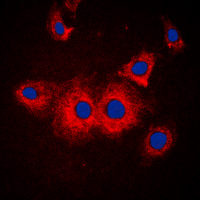 SLK Antibody - Immunofluorescent analysis of SLK staining in MCF7 cells. Formalin-fixed cells were permeabilized with 0.1% Triton X-100 in TBS for 5-10 minutes and blocked with 3% BSA-PBS for 30 minutes at room temperature. Cells were probed with the primary antibody in 3% BSA-PBS and incubated overnight at 4 C in a humidified chamber. Cells were washed with PBST and incubated with a DyLight 594-conjugated secondary antibody (red) in PBS at room temperature in the dark. DAPI was used to stain the cell nuclei (blue).