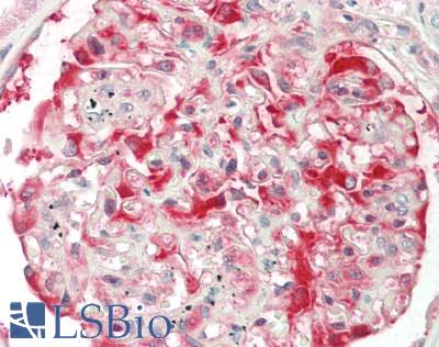 SLK Antibody - Human Kidney: Formalin-Fixed, Paraffin-Embedded (FFPE)