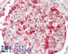 SLK Antibody - Human Kidney: Formalin-Fixed, Paraffin-Embedded (FFPE)