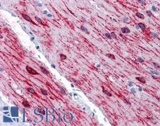 SLMAP / SLAP Antibody - Anti-SLMAP antibody IHC of human small intestine, muscularis propria. Immunohistochemistry of formalin-fixed, paraffin-embedded tissue after heat-induced antigen retrieval. Antibody concentration 5 ug/ml.