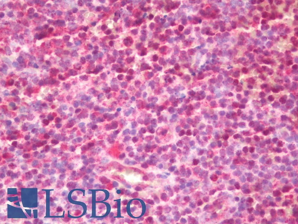 SLX4 Antibody - Human Tonsil: Formalin-Fixed, Paraffin-Embedded (FFPE)