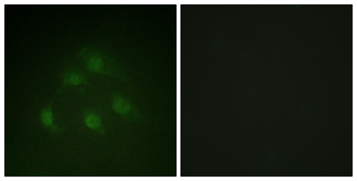 SMAD1 Antibody - Immunofluorescence analysis of HeLa cells, using Smad1 Antibody. The picture on the right is blocked with the synthesized peptide.