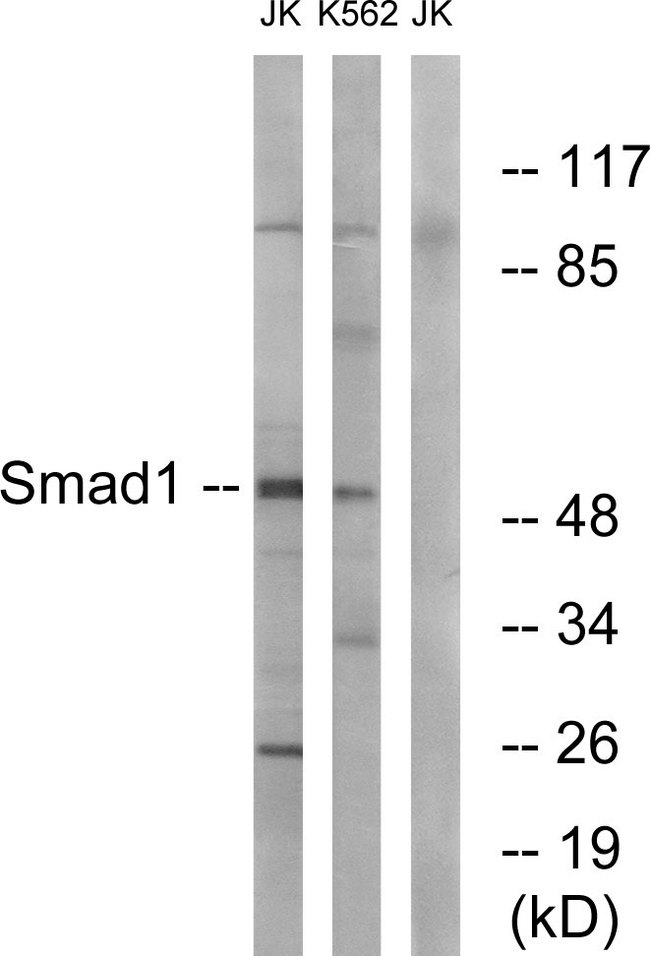 SMAD1 Antibody - Western blot analysis of lysates from Jurkat and K562 cells, using Smad1 Antibody. The lane on the right is blocked with the synthesized peptide.