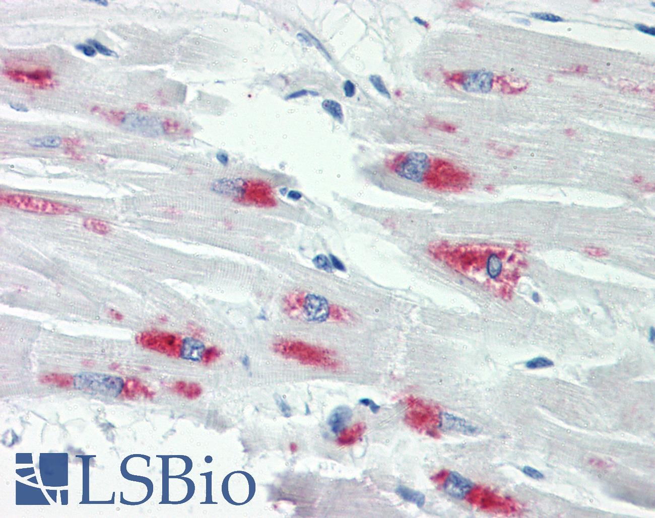 SMAD2+3 Antibody - Anti-SMAD2+3 antibody IHC staining of human heart. Immunohistochemistry of formalin-fixed, paraffin-embedded tissue after heat-induced antigen retrieval. Antibody dilution 1:50.