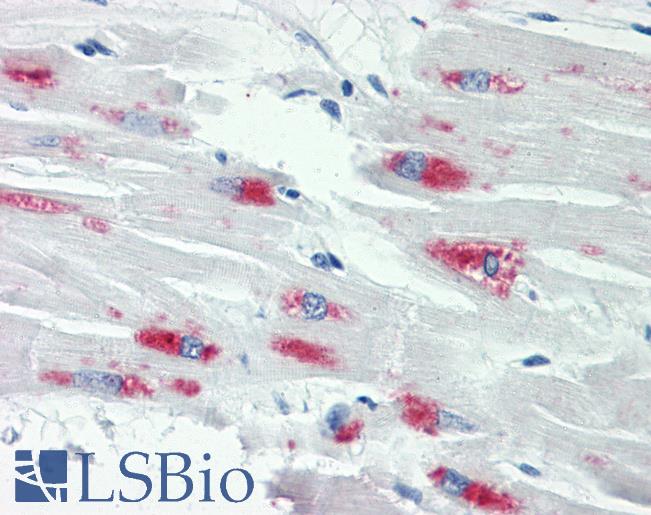 SMAD2+3 Antibody - Anti-SMAD2+3 antibody IHC staining of human heart. Immunohistochemistry of formalin-fixed, paraffin-embedded tissue after heat-induced antigen retrieval. Antibody dilution 1:50.