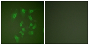 SMAD2 Antibody - Immunofluorescence of HepG2 cells, using Smad2 Antibody. The sample on the right was incubated with synthetic peptide.