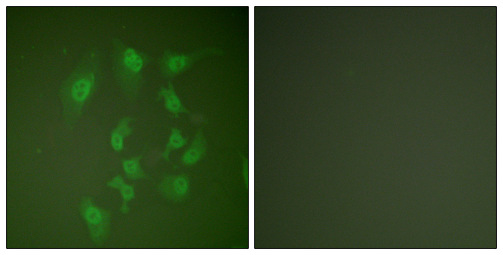 SMAD2 Antibody - Immunofluorescence analysis of HepG2 cells, using Smad2 Antibody. The picture on the right is blocked with the synthesized peptide.