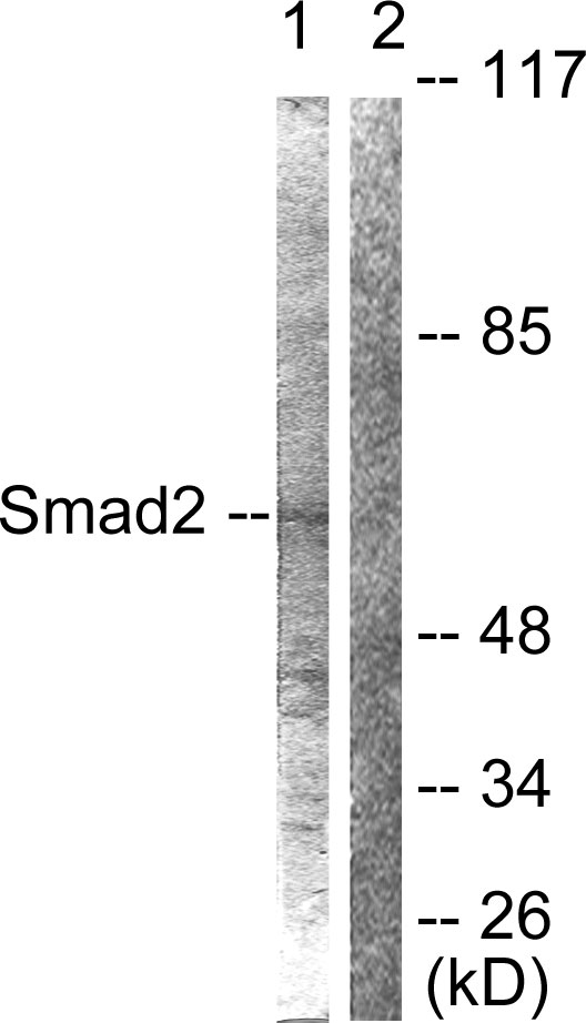 SMAD2 Antibody - Western blot analysis of lysates from HepG2 cells, using Smad2 Antibody. The lane on the right is blocked with the synthesized peptide.