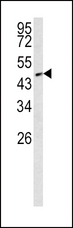 SMAD2 Antibody - Western blot of SMAD2 Antibody (T220) in NCI-H460 cell line lysates (35 ug/lane). SMAD2 (arrow) was detected using the purified antibody.