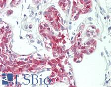 SMAD3 Antibody - Human Breast: Formalin-Fixed, Paraffin-Embedded (FFPE)