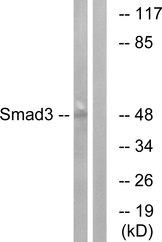 SMAD3 Antibody - Western blot analysis of lysates from HUVEC cells, using Smad3 Antibody. The lane on the right is blocked with the synthesized peptide.