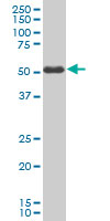 SMAD3 Antibody - SMAD3 monoclonal antibody clone 2C12. Western blot of SMAD3 expression in human colon.