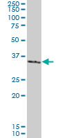 SMAD3 Antibody - SMAD3 monoclonal antibody clone 7F3. Western blot of SMAD3 expression in human colon.
