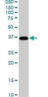 SMAD3 Antibody - SMAD3 monoclonal antibody clone 7F3. Western blot of SMAD3 expression in Jurkat.