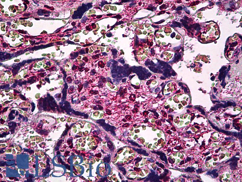 SMAD3 Antibody - Anti-SMAD3 antibody IHC of human placenta. Immunohistochemistry of formalin-fixed, paraffin-embedded tissue after heat-induced antigen retrieval. Antibody concentration 2.5 ug/ml.