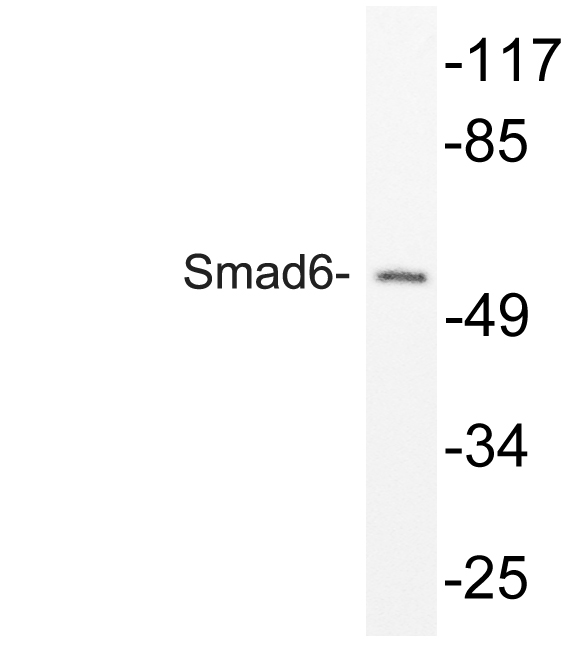 SMAD6 Antibody - Western blot analysis of lysate from mouse brain, using Smad6 antibody.