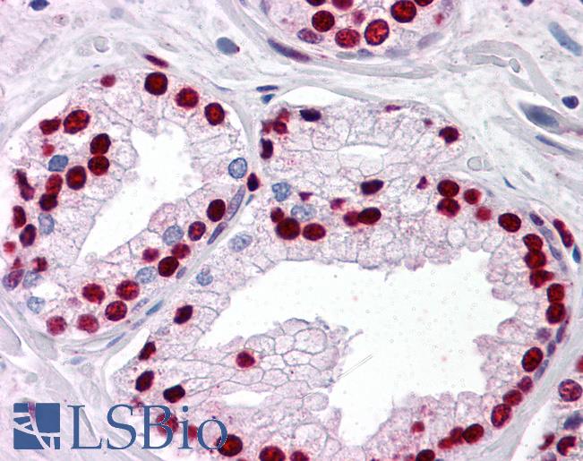 SMAD6 Antibody - Anti-SMAD6 antibody IHC of human prostate. Immunohistochemistry of formalin-fixed, paraffin-embedded tissue after heat-induced antigen retrieval. Antibody concentration 5 ug/ml.