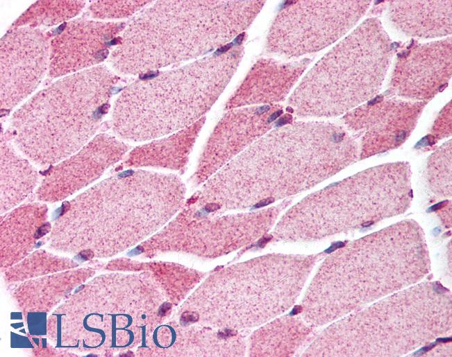 SMAD7 Antibody - Anti-SMAD7 antibody IHC of human skeletal muscle. Immunohistochemistry of formalin-fixed, paraffin-embedded tissue after heat-induced antigen retrieval. Antibody concentration 10 ug/ml.