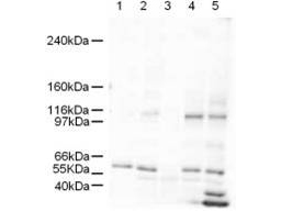 SMARCAL1 Antibody - Anti-SmarcAL1 Antibody - Western Blot. Western blot of Affinity Purified anti-SmarcAL1 antibody shows detection of a band ~106 kD band (arrowhead) corresponding to SmarcAL1 in human derived cultured cell lysates (HeLa nuclear extract lane 1, HeLa lane 2, A431 lane 3, Jurkat lane 4, and 293 lane 5). Approximately 5 ug of each lysates was run on a SDS-PAGE and transferred onto nitrocellulose followed by reaction with a 1:500 dilution of anti-SmarcAL1 antibody. Signal was detected using standard techniques. SmarcAL1 is the band seen between the 97 and 116kD markers.