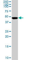 SMARCB1 / INI1 Antibody - Western blot of SMARCB1 expression in HeLa nuclear extract.