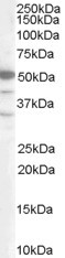 SMARCE1 / BAF57 Antibody - Antibody staining (0.2 ug/ml) of Jurkat lysate (RIPA buffer, 35 ug total protein per lane). Primary incubated for 1 hour. Detected by Western blot of chemiluminescence.