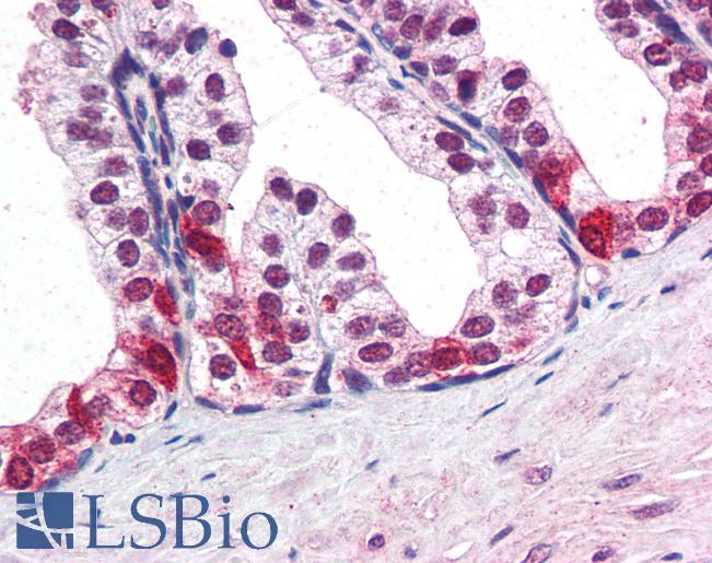 SMARCE1 / BAF57 Antibody - Anti-SMARCE1 antibody IHC of human prostate. Immunohistochemistry of formalin-fixed, paraffin-embedded tissue after heat-induced antigen retrieval. Antibody concentration 75 ug/ml.