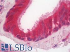 SMCO1 Antibody - Human Lung: Formalin-Fixed, Paraffin-Embedded (FFPE)