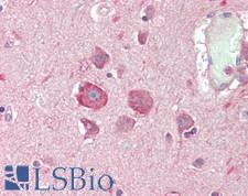 SMG6 Antibody - Human Brain, Cortex: Formalin-Fixed, Paraffin-Embedded (FFPE)