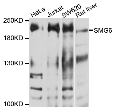 SMG6 Antibody - Western blot analysis of extracts of various cell lines, using SMG6 antibody at 1:1000 dilution. The secondary antibody used was an HRP Goat Anti-Rabbit IgG (H+L) at 1:10000 dilution. Lysates were loaded 25ug per lane and 3% nonfat dry milk in TBST was used for blocking. An ECL Kit was used for detection and the exposure time was 30s.