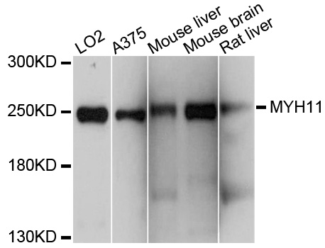 SMMHC / MYH11 Antibody - Western blot analysis of extracts of various cell lines, using MYH11 antibody at 1:1000 dilution. The secondary antibody used was an HRP Goat Anti-Rabbit IgG (H+L) at 1:10000 dilution. Lysates were loaded 25ug per lane and 3% nonfat dry milk in TBST was used for blocking. An ECL Kit was used for detection and the exposure time was 5s.