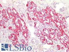 SMMHC / MYH11 Antibody - Human Breast: Formalin-Fixed, Paraffin-Embedded (FFPE)