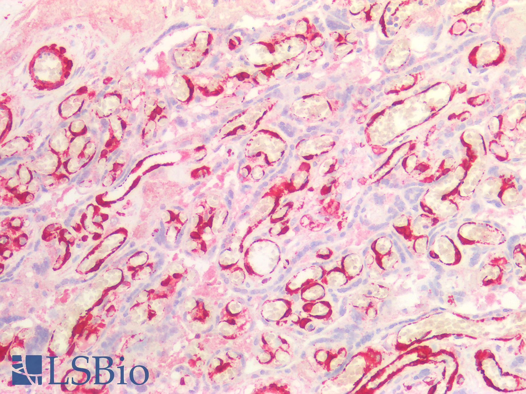 SMMHC / MYH11 Antibody - Human Placenta: Formalin-Fixed, Paraffin-Embedded (FFPE)