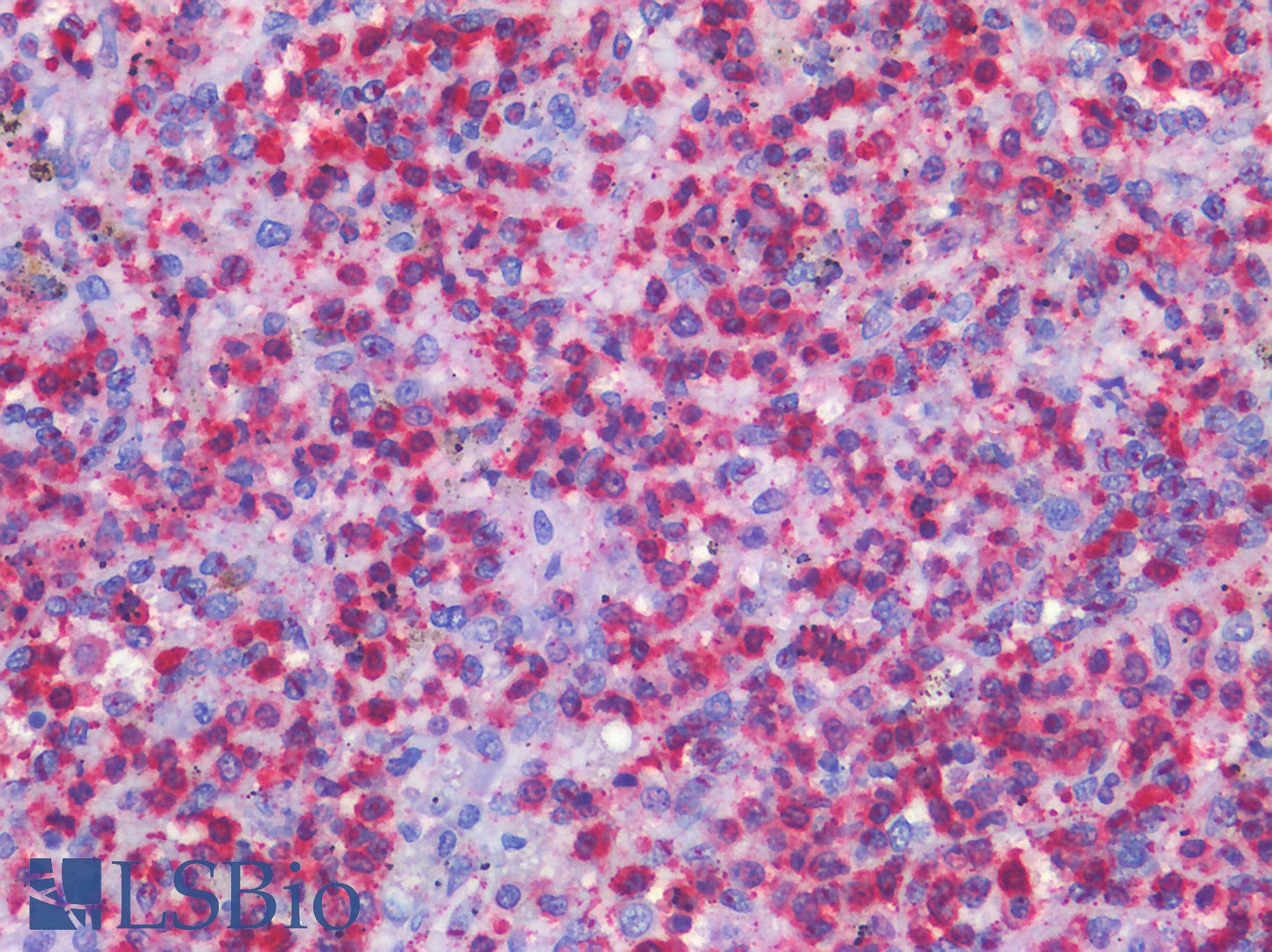SMO / Smoothened Antibody - Human Spleen: Formalin-Fixed, Paraffin-Embedded (FFPE)