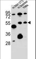 SMOC1 Antibody - SMOC1 Antibody western blot of mouse NIH-3T3 cell line and mouse bladder tissue and HeLa cell line lysates (35 ug/lane). The SMOC1 antibody detected the SMOC1 protein (arrow).