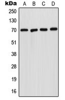 SMPD1 / Acid Sphingomyelinase Antibody - Western blot analysis of Acid Sphingomyelinase expression in A431 (A); HepG2 (B); SP2/0 (C); H9C2 (D) whole cell lysates.