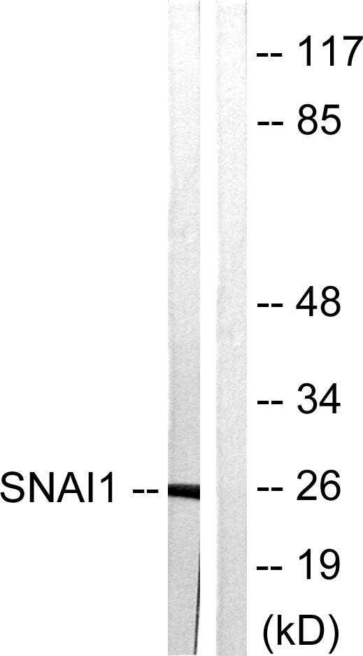 SNAI1 / SNAIL-1 Antibody - Western blot analysis of lysates from HT29 cells, using SNAI1 Antibody. The lane on the right is blocked with the synthesized peptide.