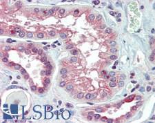 SNAI1 / SNAIL-1 Antibody - Human Kidney: Formalin-Fixed, Paraffin-Embedded (FFPE)