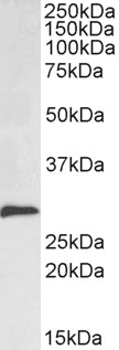 SNAI1 / SNAIL-1 Antibody - Goat Anti-Snail homolog 1 / SNAI1 Antibody (0.1µg/ml) staining of Rat Kidney lysate (35µg protein in RIPA buffer). Detected by chemiluminescencence.