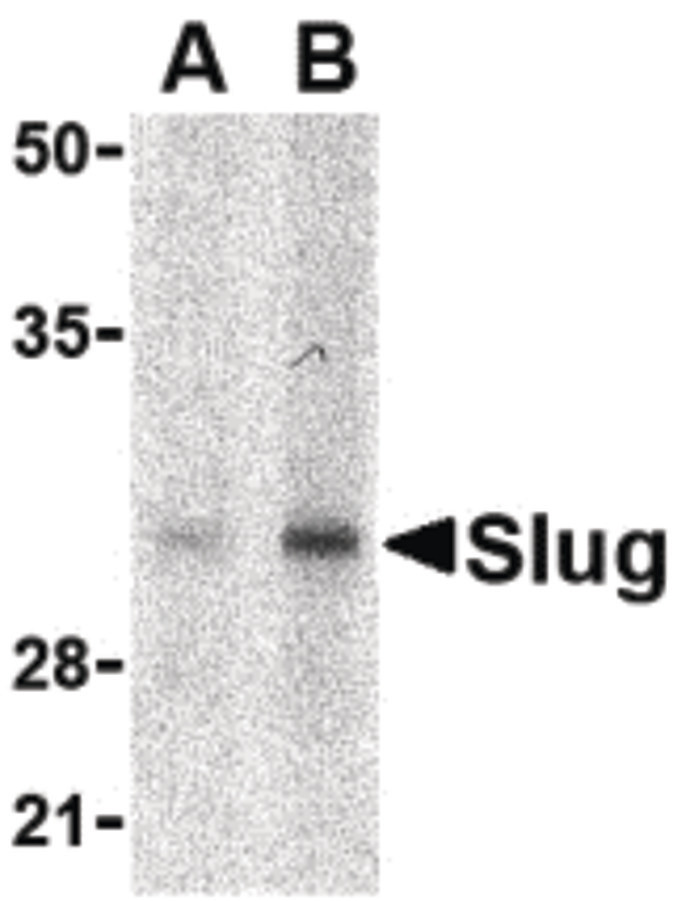 IHC-plus™ SNAI2 / SLUG Polyclonal Antibody Rabbit anti-Human 