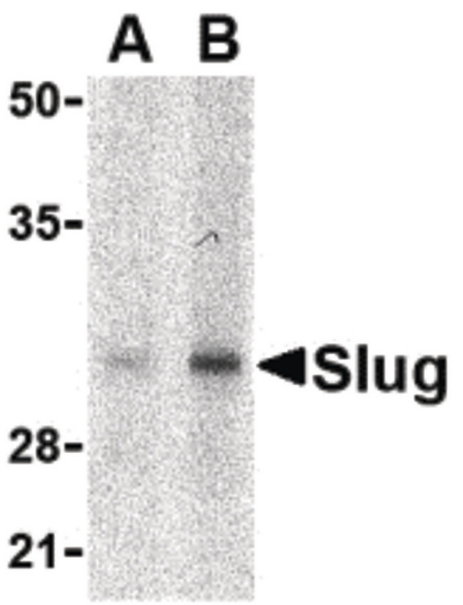 SNAI2 / SLUG Antibody - Western blot of Slug in human kidney cell lysate with Slug antibody at in (A) 1 and (B) 2 ug/ml.