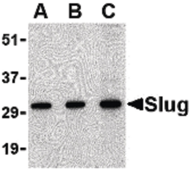 SNAI2 / SLUG Antibody - Western blot of Slug in 293 cell lysate with Slug antibody at in (A) 0.5, (B) 1 and (C) 2 ug/ml.