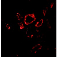 SNAI2 / SLUG Antibody - Immunofluorescence of Slug in human kidney tissue with Slug antibody at 20 µg/mL.