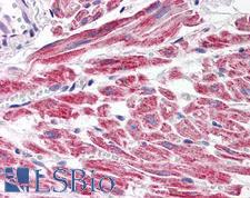 SNAI2 / SLUG Antibody - Anti-SNAI2 / SLUG antibody IHC of human heart. Immunohistochemistry of formalin-fixed, paraffin-embedded tissue after heat-induced antigen retrieval. Antibody concentration 5 ug/ml.