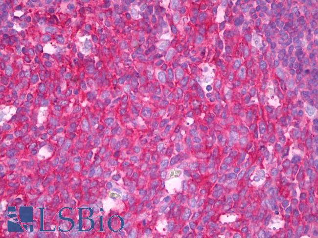 SNAP23 / SNAP-23 Antibody - Anti-SNAP23 antibody IHC of human tonsil, germinal center. Immunohistochemistry of formalin-fixed, paraffin-embedded tissue after heat-induced antigen retrieval. Antibody concentration 10 ug/ml.