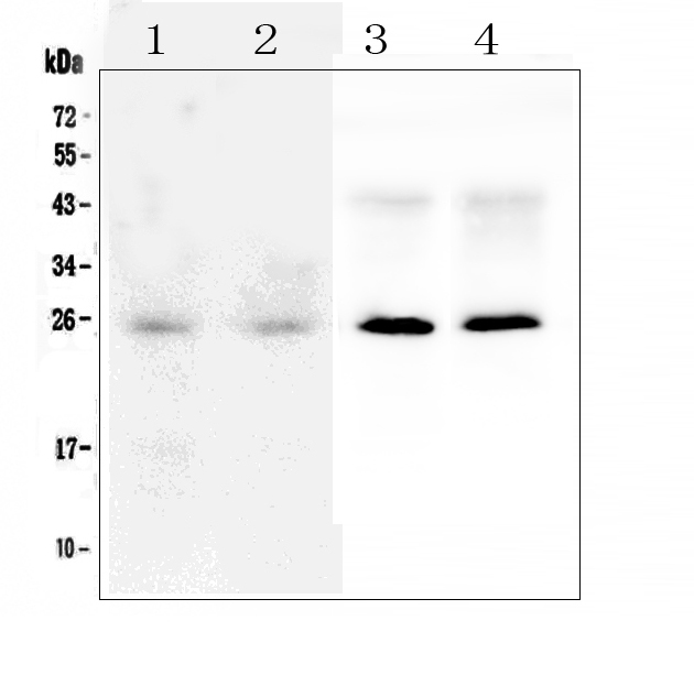 SNAP25 Antibody - Western blot analysis of SNAP25 using anti-SNAP25 antibody. Electrophoresis was performed on a 5-20% SDS-PAGE gel at 70V (Stacking gel) / 90V (Resolving gel) for 2-3 hours. The sample well of each lane was loaded with 50ug of sample under reducing conditions. Lane 1: human Hela whole cell lysate,Lane 2: human U-87MG whole cell lysate,Lane 3: rat brain tissue lysates,Lane 4: mouse brain tissue lysates. After Electrophoresis, proteins were transferred to a Nitrocellulose membrane at 150mA for 50-90 minutes. Blocked the membrane with 5% Non-fat Milk/ TBS for 1.5 hour at RT. The membrane was incubated with rabbit anti-SNAP25 antigen affinity purified polyclonal antibody at 0.5 µg/mL overnight at 4°C, then washed with TBS-0.1% Tween 3 times with 5 minutes each and probed with a goat anti-rabbit IgG-HRP secondary antibody at a dilution of 1:10000 for 1.5 hour at RT. The signal is developed using an Enhanced Chemiluminescent detection (ECL) kit with Tanon 5200 system. A specific band was detected for SNAP25 at approximately 25KD. The expected band size for SNAP25 is at 25KD.