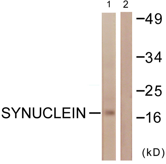 SNCA / Alpha-Synuclein Antibody - Western blot analysis of lysates from HUVEC cells, using Synuclein Antibody. The lane on the right is blocked with the synthesized peptide.