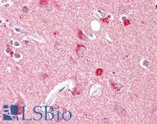 SNCA / Alpha-Synuclein Antibody - Anti-SNCA / Alpha-Synuclein antibody IHC of human brain, cortex. Immunohistochemistry of formalin-fixed, paraffin-embedded tissue after heat-induced antigen retrieval. Antibody dilution 1:100.